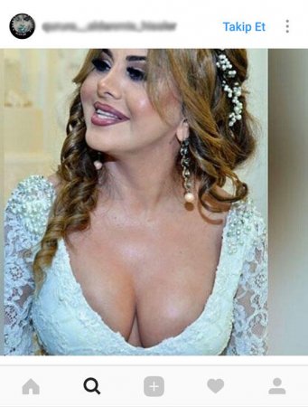 Sinəsini çöldə qoyan Mətanətdən onu tənqid edənlərə cavab: "Əcəb edirəm" - 