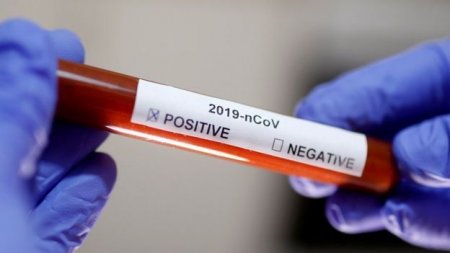 Koronavirus pandemiyası nə vaxt bitəcək? -